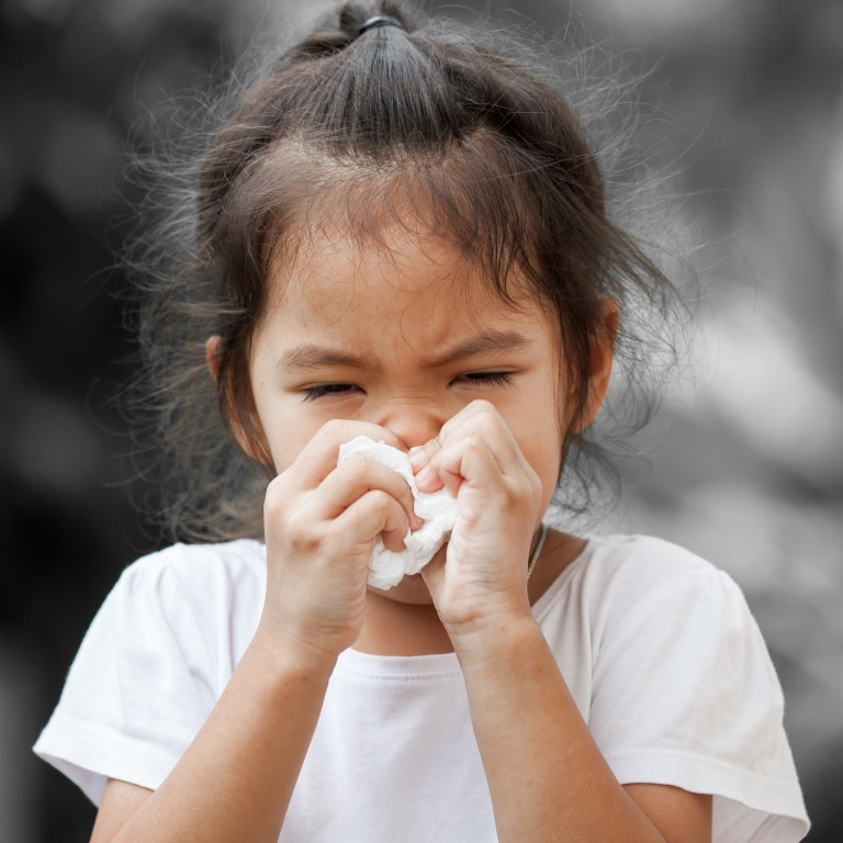 Sổ mũi ở trẻ thường do cảm lạnh