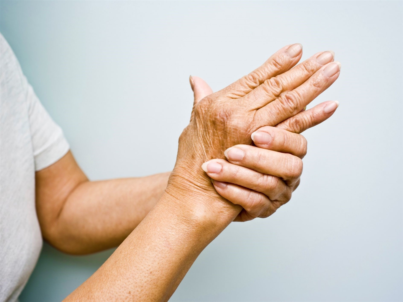 Biến dạng bàn tay là một trong những triệu chứng của viêm thoái hóa khớp bàn tay