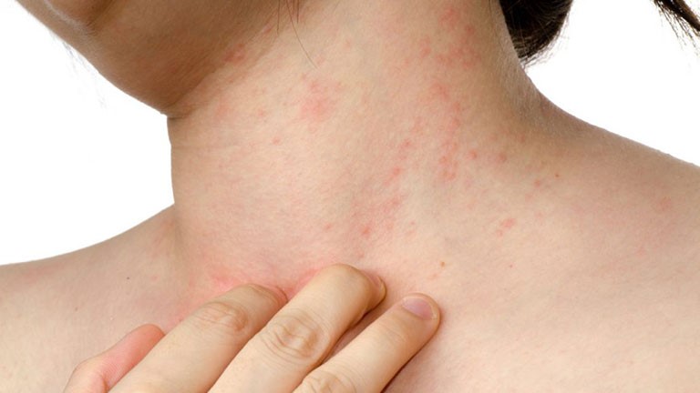 cách bổ sung lợi khuẩn