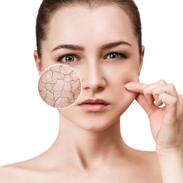 Sử dụng sữa rửa mặt có độ pH quá cao gây khô da
