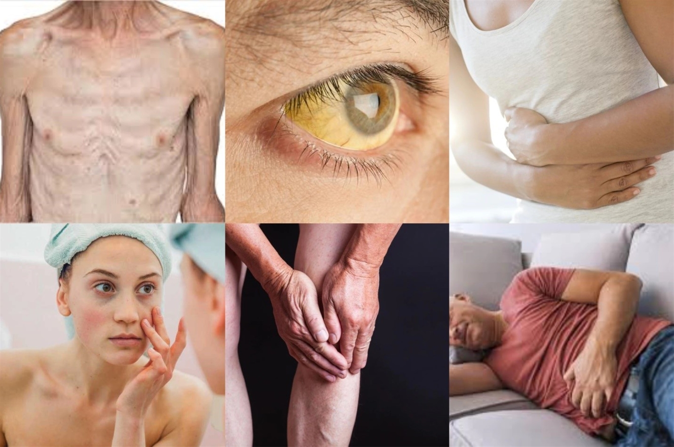 Người bệnh viêm gan B thường gặp rất nhiều triệu chứng nghiêm trọng cho cơ thể