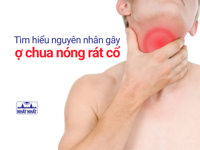 ợ chua nóng rát cổ