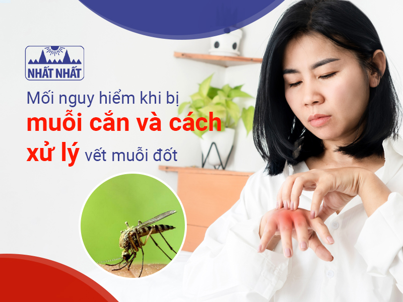 23 cách đuổi muỗi và diệt muỗi trong phòng ngủ hiệu quả nhất