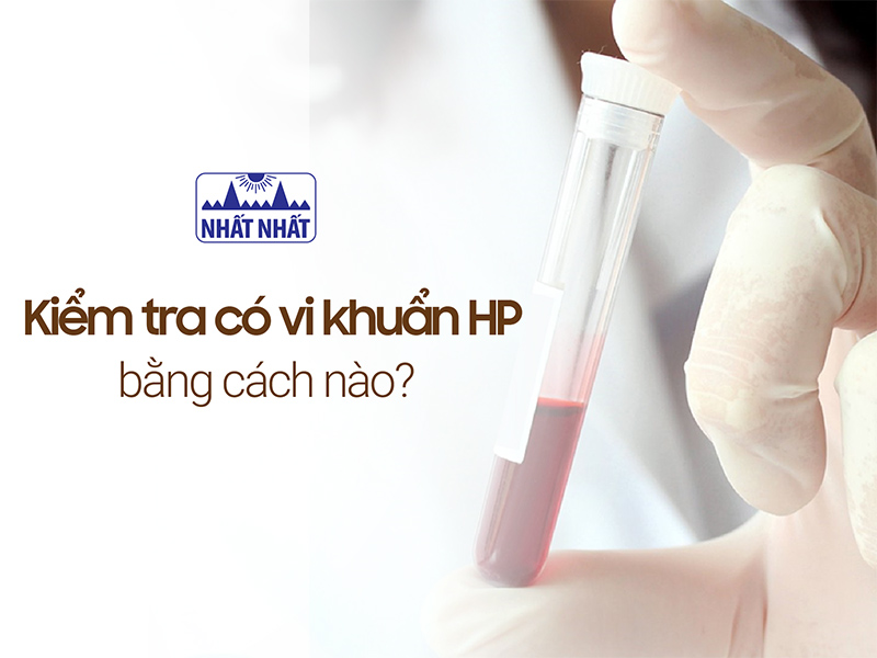 kiểm tra có vi khuẩn hp bằng cách nào