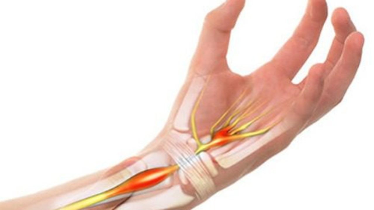 đau khớp cổ tay