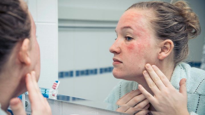 Dị ứng da mặt là một trong những tình trạng phổ biến trên da