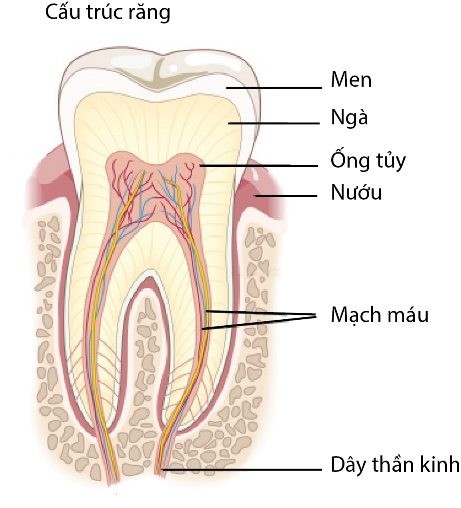 điều trị viêm nướu răng