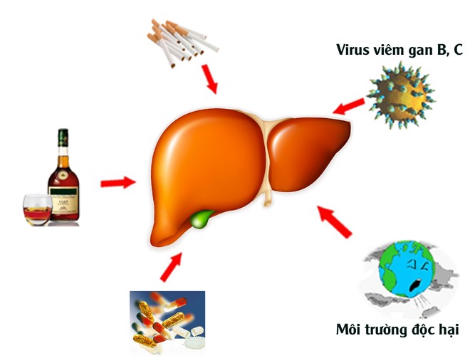 nhận biết gan nhiễm độc