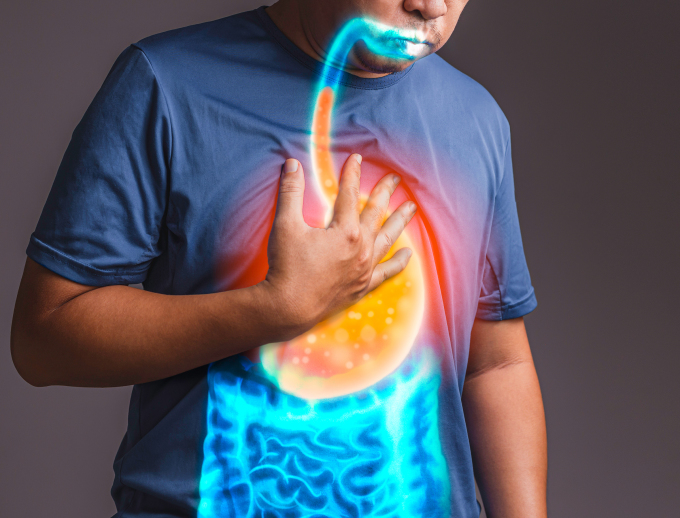 Ho ngứa họng do trào ngược dạ dày - thực quản không thể điều trị bằng cách giảm triệu chứng