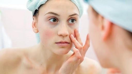 Hương liệu trong mỹ phẩm có thể gây kích ứng da