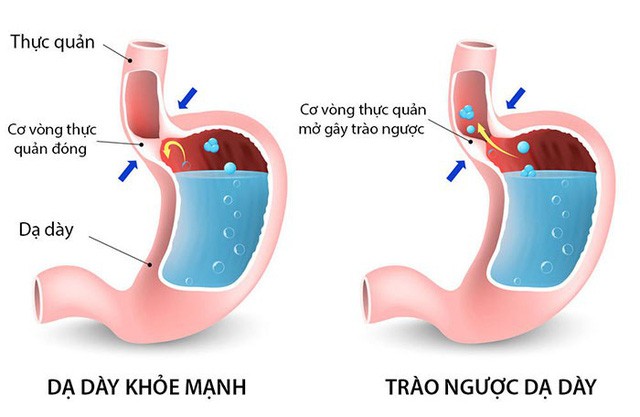 khản tiêng sau khi ngủ dậy