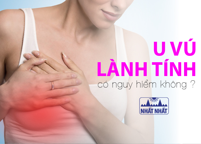 u vú lành tính