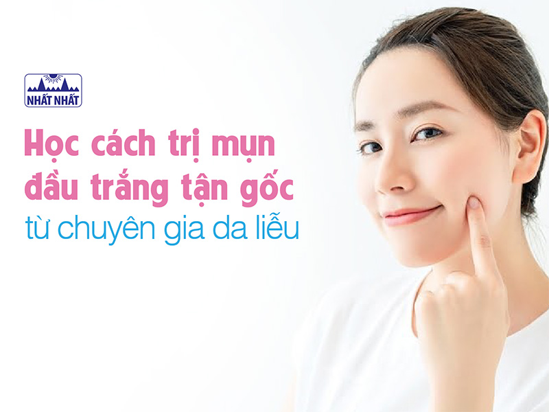 cách trị mụn đầu trắng