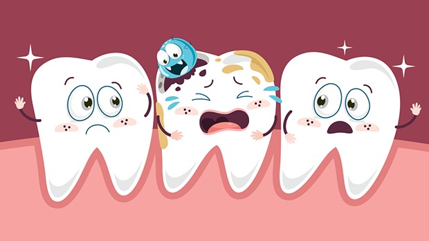 sâu răng hàm có lỗ nên làm gì