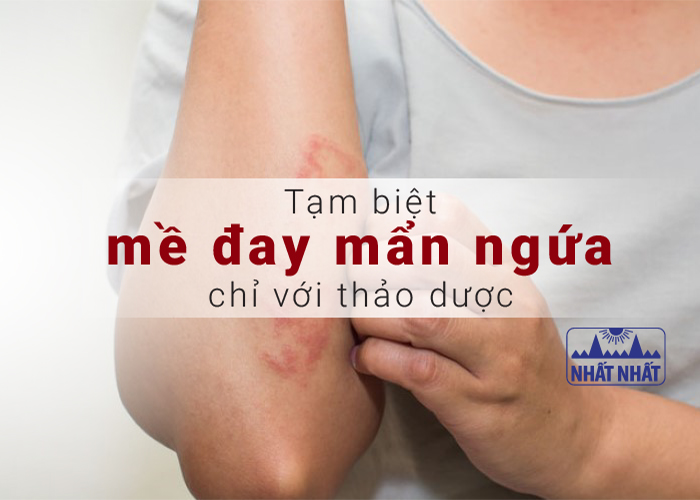 mề đay mẩn ngứa