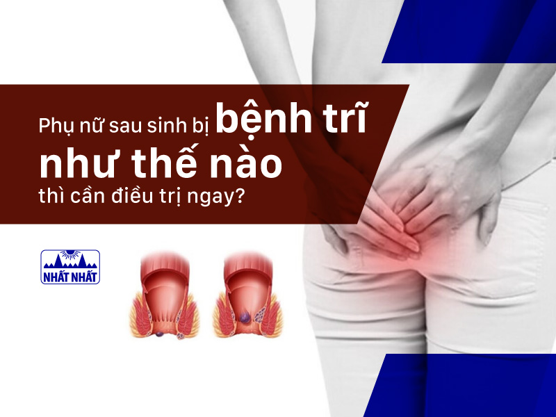 bệnh trĩ như thế nào