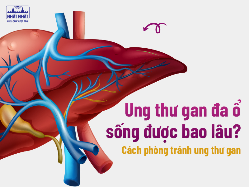 Bệnh nhân ung thư gan đa ổ sống được bao lâu?