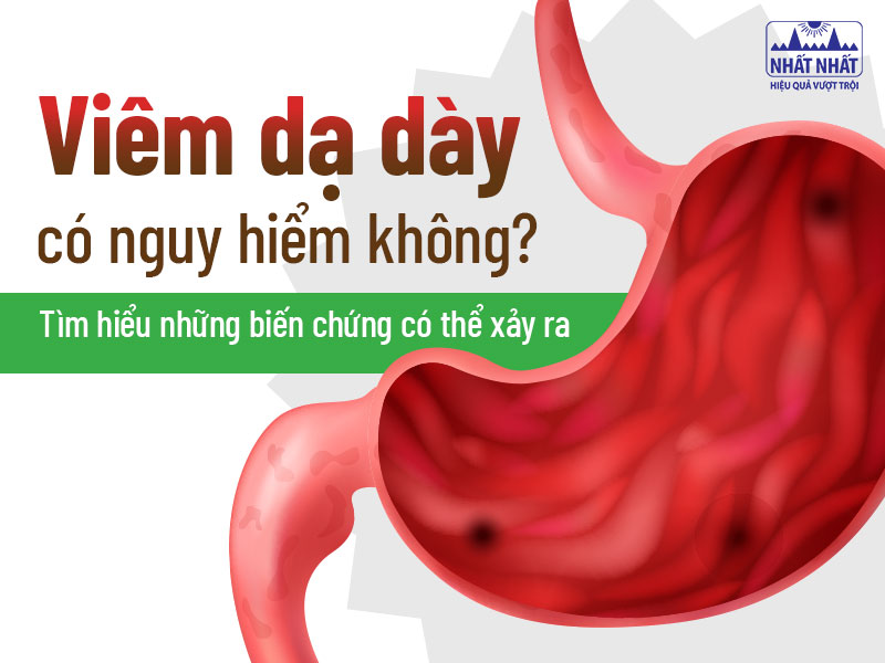 Tìm hiểu viêm dạ dày có nguy hiểm không