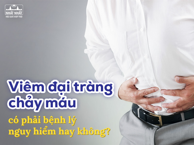 Viêm đại tràng chảy máu là bệnh lý tiêu hóa nghiêm trọng