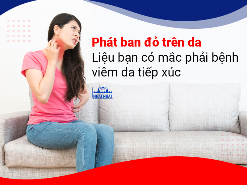 Bệnh viêm da tiếp xúc