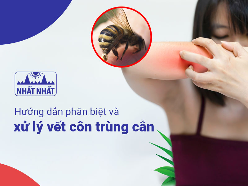 côn trùng cắn