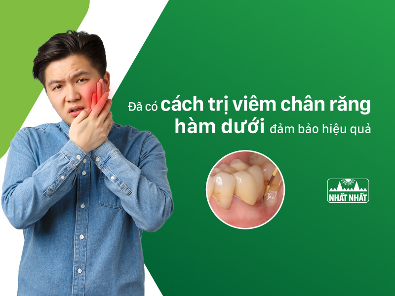 Viêm chân răng hàm dưới