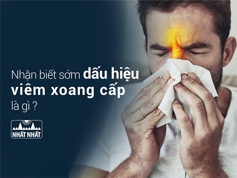 viêm xoang cấp tính là gì