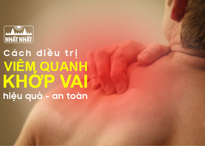 viêm quanh khớp vai