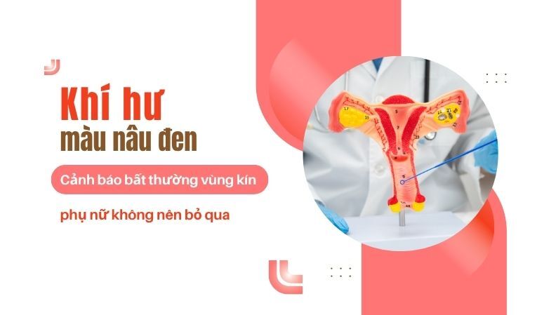Khí hư màu nâu đen – Cảnh báo bất thường vùng kín phụ nữ không nên bỏ qua