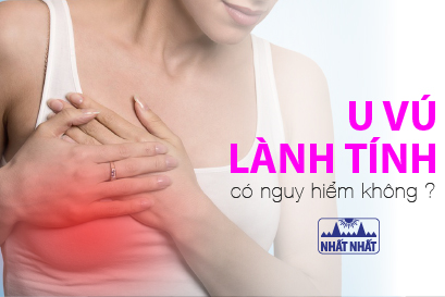 U vú lành tính có nguy hiểm không, khi nào nên mổ?