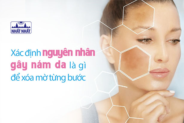 Xác định nguyên nhân gây nám da là gì để xóa mờ từng bước