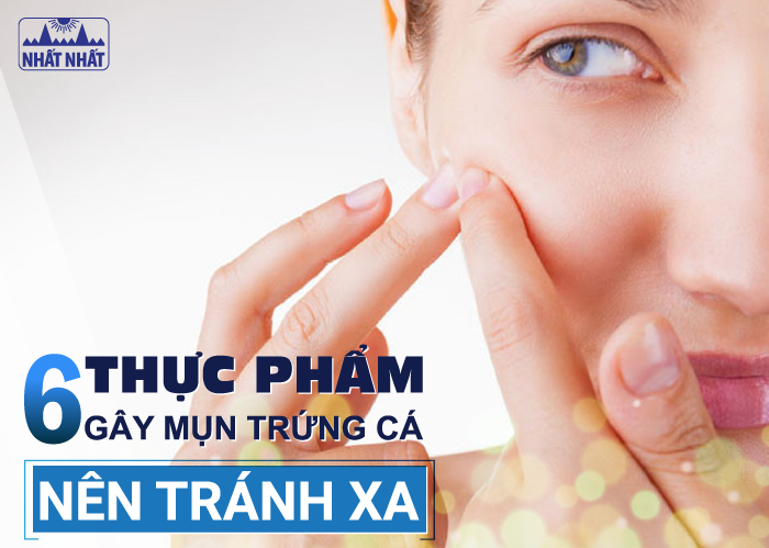 6 loại thực phẩm có thể gây ra mụn trứng cá bạn cần tránh xa