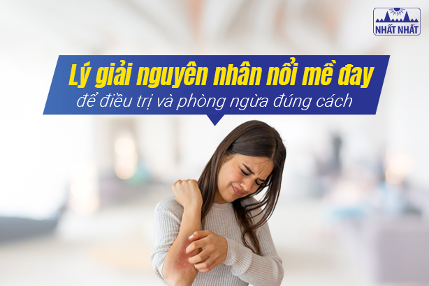 Lý giải nguyên nhân nổi mề đay để điều trị và phòng ngừa đúng cách