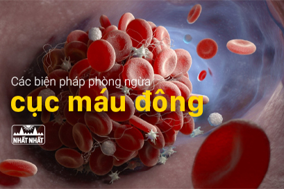 Các biện pháp phòng ngừa cục máu đông một cách tự nhiên