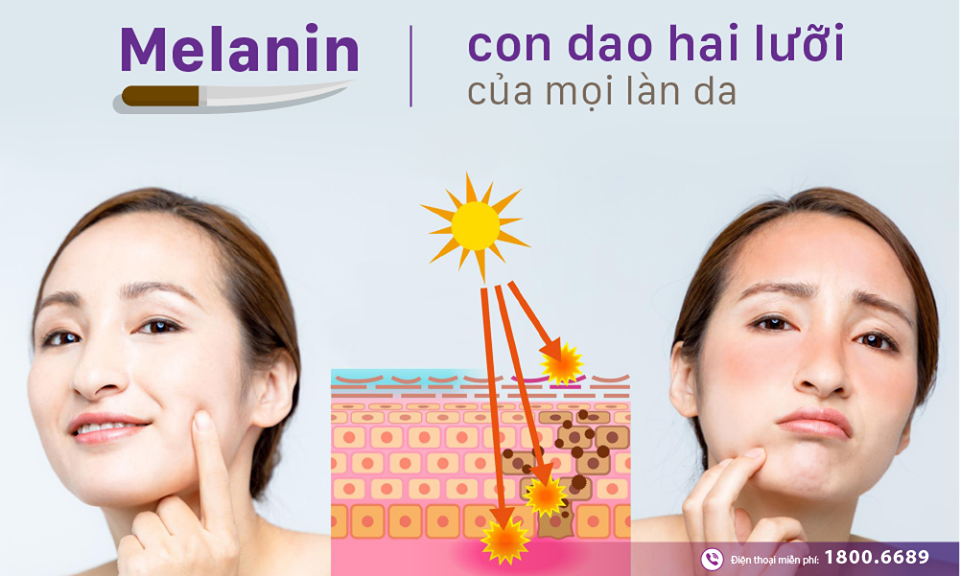 Melanin - "Con dao hai lưỡi" của mọi làn da