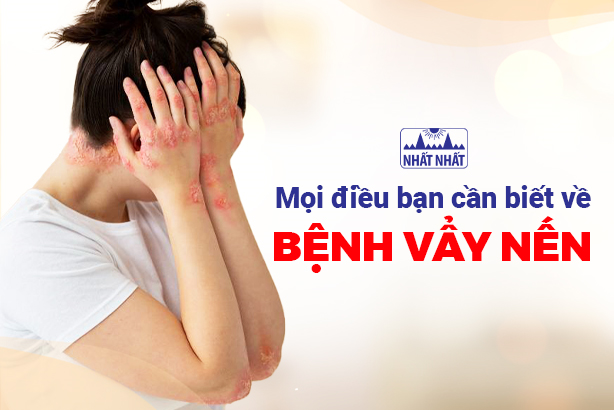 Mọi điều bạn cần biết về bệnh vẩy nến