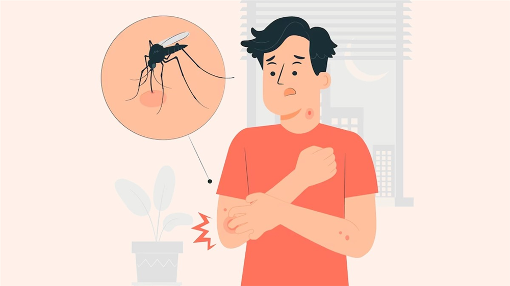 Áp dụng ngay 11 cách phòng chống muỗi đốt hiệu quả
