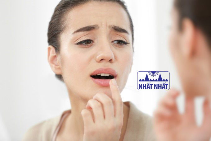 Giải đáp: Nhiệt lưỡi uống thuốc gì nhanh khỏi?