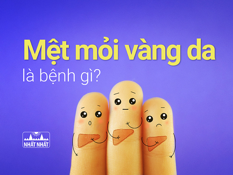 Mệt mỏi vàng da là bệnh gì, chữa thế nào?