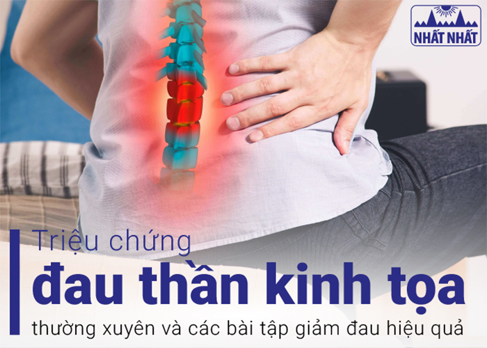 Triệu chứng đau thần kinh tọa phổ biến và các bài tập giảm đau hiệu quả 
