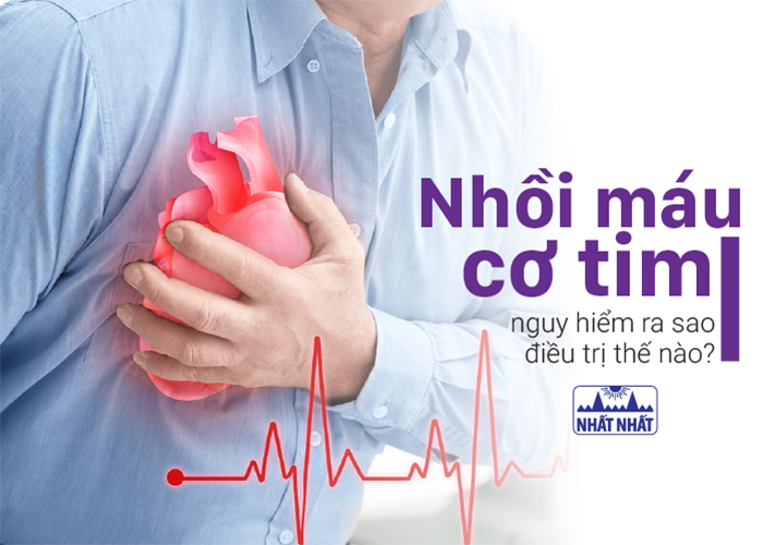 Nhồi máu cơ tim: nguy hiểm ra sao, điều trị thế nào?