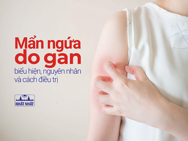 Mẩn ngứa do gan: biểu hiện, nguyên nhân và cách điều trị 