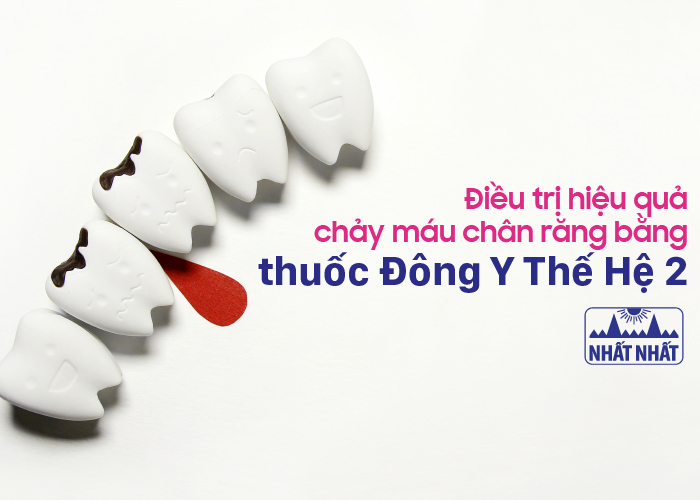 Điều trị hiệu quả chảy máu chân răng bằng thuốc Đông Y Thế Hệ 2