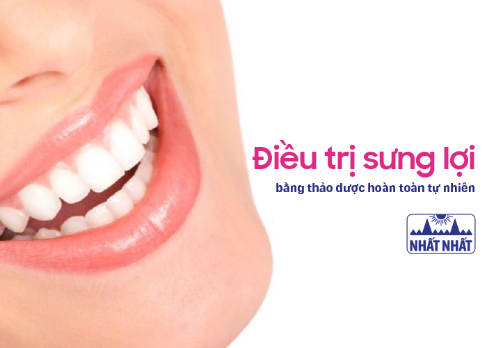 Điều trị sưng lợi bằng thảo dược hoàn toàn tự nhiên