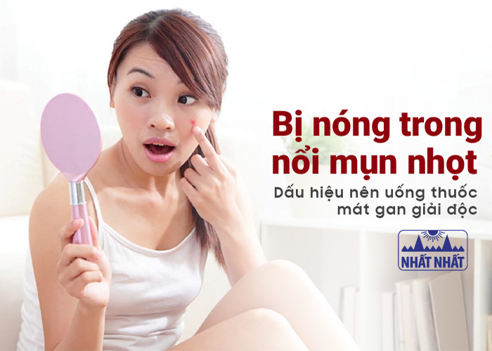 Bị nóng trong, nổi mụn nhọt – Dấu hiệu nên uống thuốc mát gan giải độc