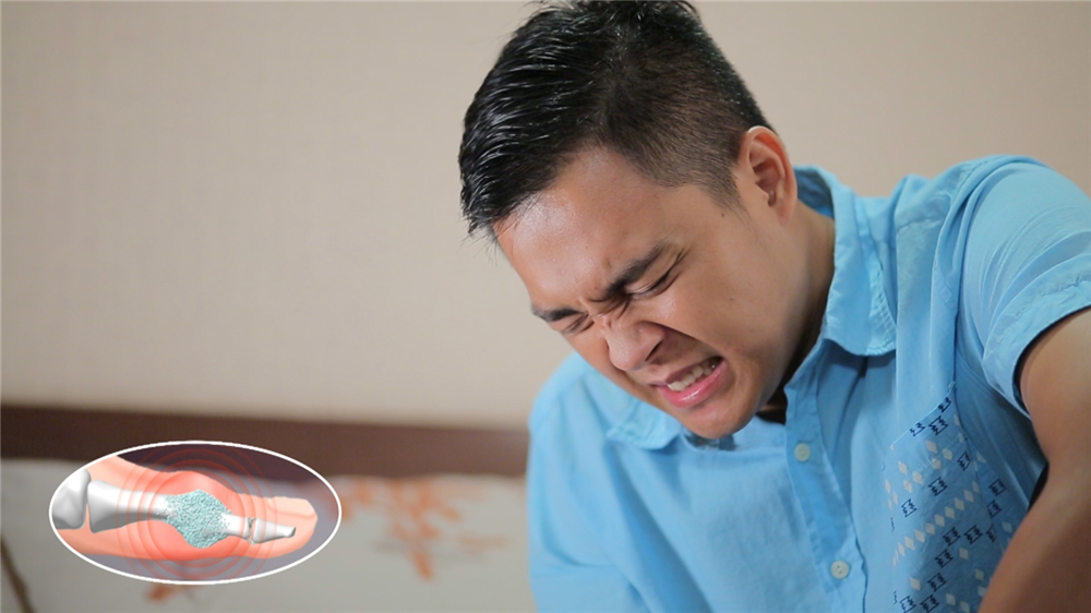 BÀI THUỐC THỐNG PHONG (GOUT) ĐÔNG Y THẾ HỆ 2 HIỆU QUẢ VƯỢT TRỘI ĐIỀU TRỊ TRIỆT ĐỂ BỆNH GOUT MẠN TÍNH