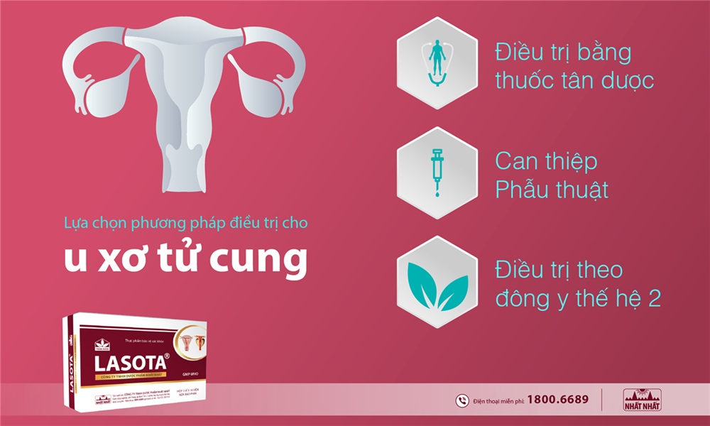 Lựa chọn phương pháp điều trị u xơ tử cung phù hợp