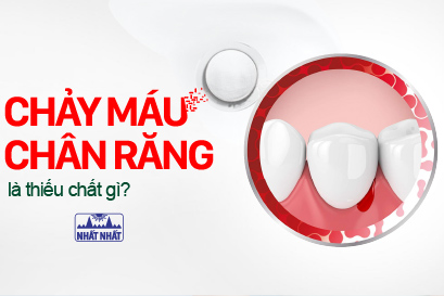 Chảy máu chân răng là thiếu chất gì, điều trị thế nào nhanh khỏi nhất?