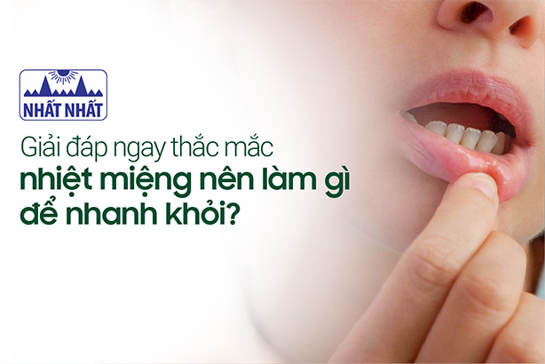 Giải đáp ngay thắc mắc nhiệt miệng nên làm gì để nhanh khỏi?