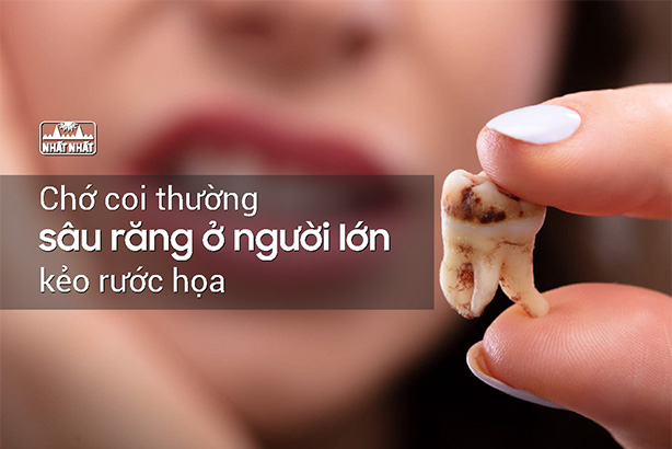 Chớ coi thường sâu răng ở người lớn kẻo rước họa!